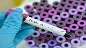 सड़कों पर घूम रहे कोरोना संक्रमित, दो लोगो के खिलाफ प्रशासन ने दर्ज करवाई एफआइआर